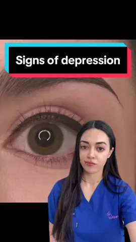 Depression may be hinted at through physical signs: teary eyes (very dry from crying) skin issues like acne, a flat or sad facial expression, tired eyes, slumped posture, slower movements, and eary grey dull or thinning hair. These signs alone aren't diagnostic, and professional evaluation is essential for accurate assessment. #depressionanxiety #depression #anxiety #stress #cortisol #MentalHealth #acne #eyes #hair #skincare #thinhair #greyhair #foryou #foryoupage #fyp 