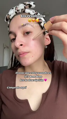 Super Serum Skin Tint SPF 40 para el cuidado de la piel, está clínicamente probado que mejora la apariencia de sequedad, imperfecciones, enrojecimiento, arrugas e incluso el tono con el tiempo. Además, es vegano, no comedogénico, seguro para pieles sensibles y está formulado sin fragancia, gluten ni silicona, y lo que mas me gusta… ¡es de color!😍 es decir que no necesitas aplicarte base y estas cuidando tu piel. #tiktokshop #iliabeauty #mamaprimeriza💜💓 #tiempoparami✨ 