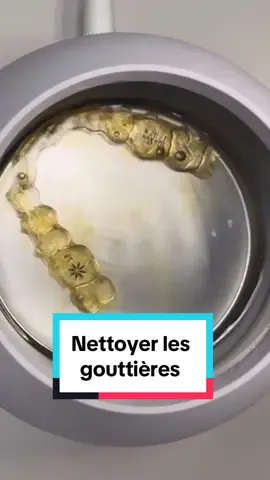 La meilleure façon de nettoyer les gouttieres #invisalign #braces #invisible #aligneurs #appareil #orthodontist #retainer #nettoyer #clean #ultrasonic #ultrasoniccleaner  #gouttieredentaire #drsmile #teeth #tips #gutters #beforeandafter