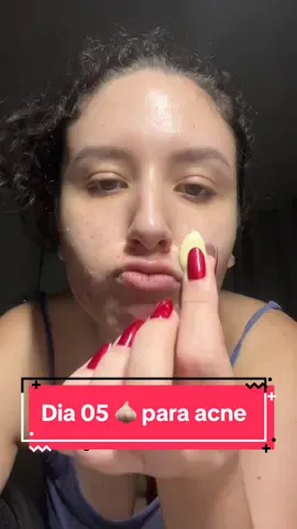 🧄 para desinflamar acne #acne #acnehormonal #clearskincheck #alhoparaacne #alhocru 