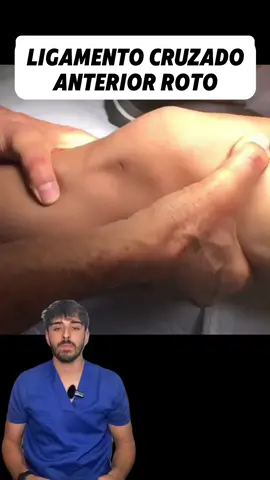 ❗️👇🏽IMPORTANTE👇🏽❗️ 👉🏼 Os traigo un increíble artículo donde ven que con un protocolo específico se recuperaron hasta el 90% de los ligamentos cruzados sin necesidad de cirugía. 🚨 Es importante saber que a día de hoy la opción de un tratamiento u otro dependerá en gran medida de tus objetivos. 📈 Sin embargo, a día de hoy necesitamos más evidencia, comparando un tratamiento con el otro, para ver cuál es mejor y más óptimo para recuperar tu ligamento. 📚 Artículos: PMID: 37316199 PMID: 22962290 ❕SIGUEME PARA ALIVIAR TU DOLOR Y RECUPERARTE GRATIS❕ #fisioterapia #fisio #dolor #dolorcronico #dolorcervical #dolordeespalda #vertigo #rehabilitacion #anatomia #anatomiahumana #ejercicio #Fitness #manguitorotador #hombro #ciática #lesión #terapiamanual #lca #manipulacionvertebral #menisco#lugamentocruzadoanterior #ligamentocruzado #rodilla #dolorderodilla 