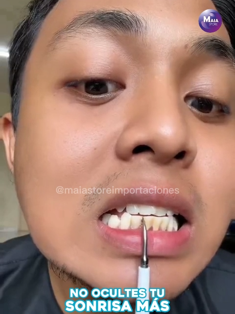 No ocultes tu sonrisa más 🦷 #dientes #dientesblancos #cepillo #quitasarro #cepilloelectrico #dental