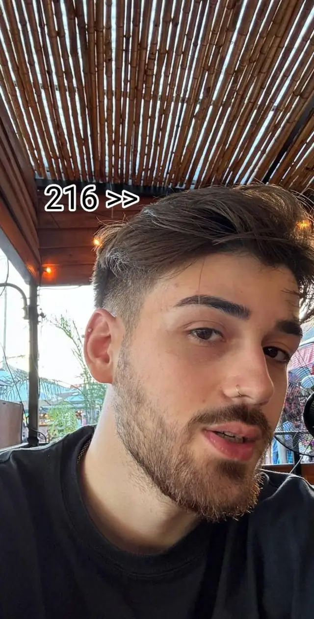 Where are you from? @kekmundo #keremakyol #fyp #kekmundo #turkey🇹🇷 