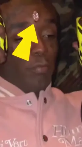 Lil Uzi Vert $24,000,000 Diamond Get’s STOLEN😳