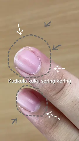 Aku pribadi lebih suka pake ini buat kuku daripada bibir😁 tapi jangan samakan hand cream sama pure pawpaw ya! Karena texturenya beda, so aku saranin pakainya dikit2 aja atau di malam hari aja!🥰  #purepawpaw #pawpaw #lipbalm #kulitkering #bibirkering #ointment #fyp #fypシ゚viral #viral 