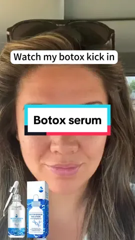 Love it🥰 it was my first time to use the Botox serum and results so amazing🤗🤗#antiaging #skincare #health #fyp #viral #tiktokmademebuyit #botoxbeforeansafter 