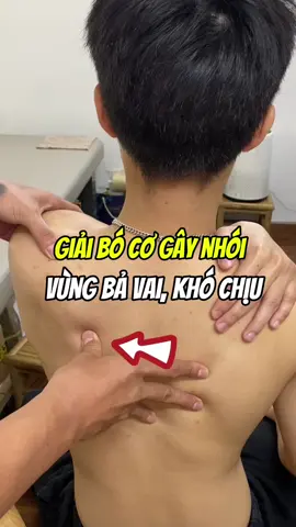 Giải bó cơ gây nhói vùng bả vai cực kỳ khó chịu #daucovaigay #đauvaigáy #trilieuvaigay #nhiquocduong #daunhucxuongkhop #trilieucovaigay #trịliệu 