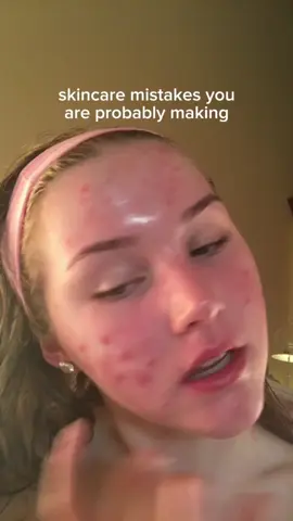 acne? LISTEN UP✨ the acne safe protein powder is @Free Soul vegan protein blend (it has hormome balancing ingredients too!), code LIFEWITHMILS gives discount! *acne healing guides in my bio* #acne #acnetips #clearskin #clearskintips #skincare #skincaretips #skintok #fyp #explore 