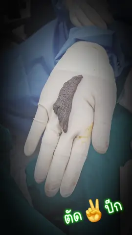 ตัด✌️ปีก#เทรนด์วันนี้  #ladycentermasterpiece #มาสเตอร์พีซ #ทุกปันหากีจบที่นี่ที่เดียว  #ศูนย์ดูแลจุดซ่อนเร้น  #ตัดเลเบียมาสเตอร์พีช