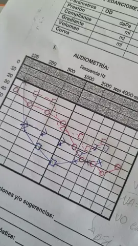 terribleee 🫠🫠#audiometria #fonoaudiologia #audiology 