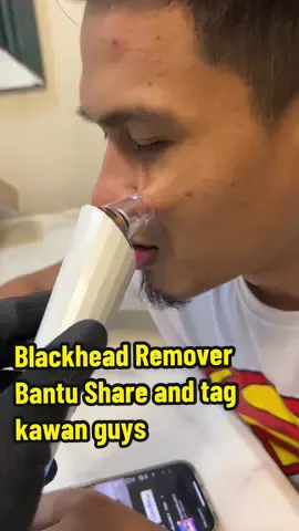 Electric Rechargeable Blackhead Remover With 3 Level Suction Adjustable Facial Skin Cleanser Acne Vacuum Suction Pore Cleaner Machine Acne Elektrik Remover#blackhead #blackheadremover #blackheadsremoval #fyp 