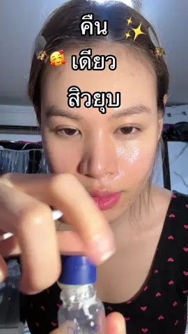 สงสัยยาแต้มสิวใช้ดี สิวเลยขึ้นฉ่ำ 😂#Dr.LeoSkincareTH#drleo#drleoTH#AcneBuster#AcneSolution#BlemishFree