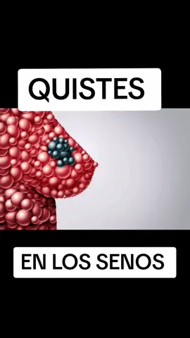 🇺🇸🇺🇸🇺🇸🇺🇸🇺🇸🇺🇸🇺🇸 LOS QUISTES SON SACOS DE LÍQUIDOS, CAUSAN MUCHO DOLOR Y ALTERACIÓN EN TUS HORMONAS👇👇👇👇👇COMENTA SI TIENES QUISTES O TU OR EN LOS SENOS... PARA INDICARTE COMO DESINTEGRARLOS Y SIN CIRUGÍA 👇👇👇👇 #hormonal#fertilidad#invitro#embarazo#femeninas🏳️‍🌈#usa🇺🇸#texasgirl 