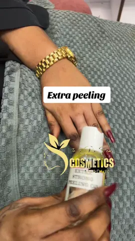 #senegalaise_tik_tok #wekh #mami #traitment #savon #peeling #cosmetics #vergetures #extra #gamme #wekhtall #tiktokviral #challange #savonvergeturepeeling #viralvideo #pourtoipage #pourtoi #pourtoiiiii #221tiktokgalsen🇸🇳 #video #22 #221tiktokgalsen🇸🇳 #pourtoii #pourtoi #senegalaise_tik_tok #pourvous #viral #@TikTok Senegal🇸🇳 @tik tok mauritanie @Dakar_Tik_Tok #tiktokindia #vous #pourtoiii #tiktokafrique🇹🇬🇨🇩🇨🇮🇧🇯🇬🇦🇨🇲🇬🇦 #tiktokmonde🌏🌎🌍 
