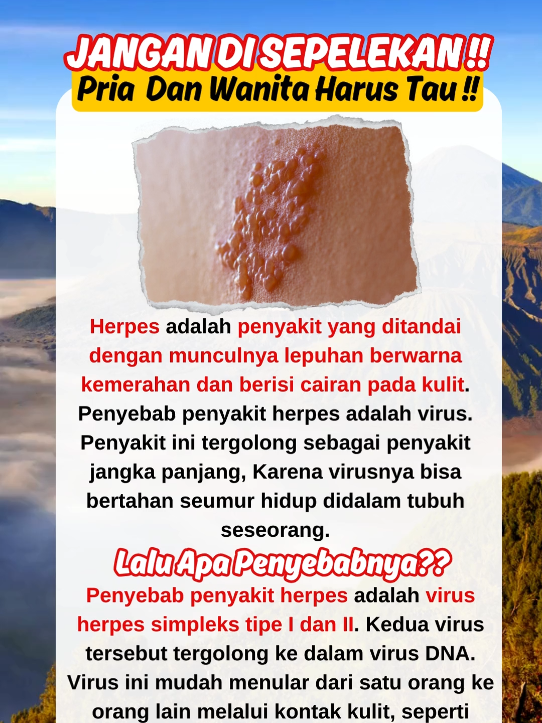 WASPADA HERPES!! JANGAN DI SEPELEKAN!! #herpes #herpessimplexvirus1 #herpesvirus #herpeskulit #herpeszoster #herpesdiwajah #herpesdisebagianwajah #herpessimplex #fypシ #fyp