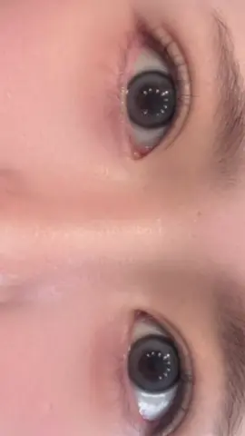 二重埋没術後1ヶ月👀 もうこんなにも馴染んでとても綺麗な仕上がりになりました💞本当にやってもらってよかったなと思います。返せるコメントはどんどん返していきます！ #クイックコスメティークダブルneo #二重 #美容整形 #美容 #整形 #埋没法 #二重整形 