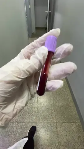 Volviendo a la rutina #laboratorio #laboratorioclinico #analisisclinicos #muestra #hospital #hematologia 