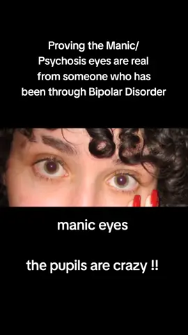 #bipolardisorder #bipolar2 #bpd #bpdtiktok #MentalHealth 