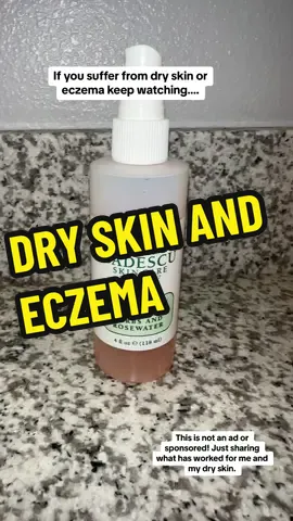 After using this facial spray from @Mario Badescu i have said GOODBYE to #dryskin and my #eczema I absolutely love this product. #dryskintips #dryskinremedies #eczemaawareness #eczematok #advicetiktok #fyp #rosewater #facial #skin #skincare #mariobadescu #skincareroutine #skincaretips 