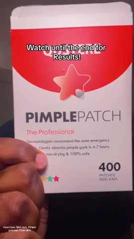 Pimple Patches for the WIN!! #creatorsearchinsights #pimplepatch  #facecare #skincareroutine #skincare #skincaretips #ad 