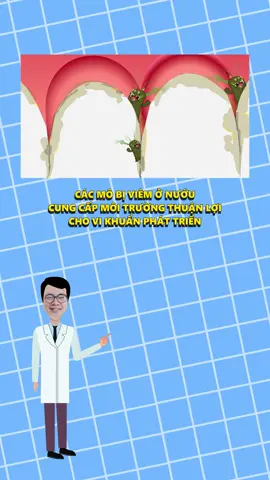 Làm thế nào để cải thiện hôi miệng do các vấn đề về nướu ? #lacalut 