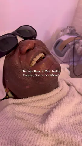 Mrs Netta Skin Journey Update: So we know you guys have been looking for updates on Mrs. Netta’s skin after her chemical peel and here it is. Tap the link in our bio to shop! #richandclear 