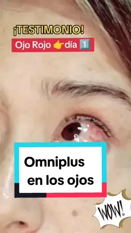 😀Testimonio de ojo Rojo! #omnilife #suplementos #natural #complejob #aspirulina #aloevera #compraonline #patentados #inflamacion #infeccion #dolor #visión #sistemaimmunitario 