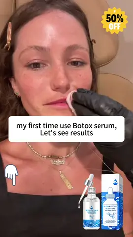 Watch my botox serum kick in🌟🌟🌟🔥🔥🥰🥰🥰#botox #botoxresults #serum #skincare #antiaging #tiktokshop #SkinCare101 #botoxinabottle 