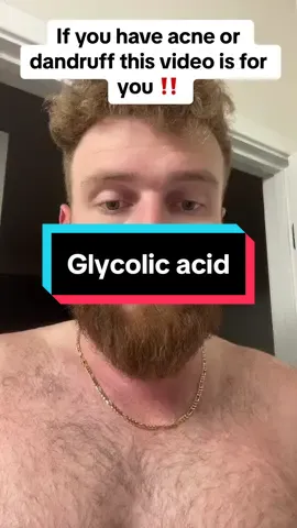 Glycolic acid will forever change your skin #skincare #skincareproducts #tiktokmademedoit #glycolicacid #clearskin 