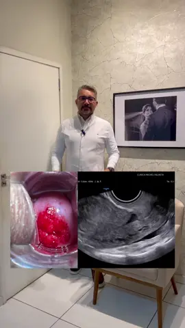 É melhor a ultrassom transvaginal ou a prevenção ginecológica?