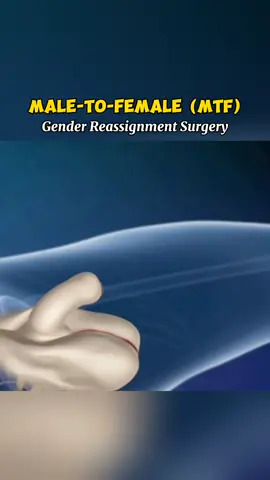 #medical #LearnOnTikTok 