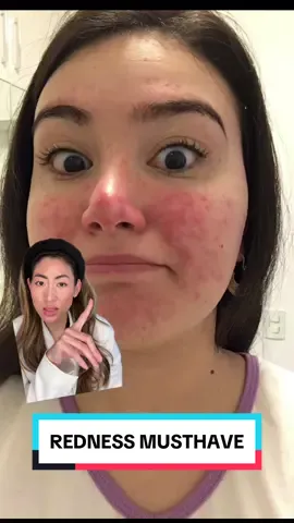If you suffer from redness and looking for something that actually works, give @physiogel_usa Calming Relief Cream a try, it’s a kbeauty staple for a reason #physiogel #redness #calmingreliefcream #sensitiveskin  