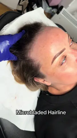 Microbladed hair like results!  #hairline #hairlinetattoo #spmu #microblading #fy #fyp #viral #tiktok #hairloss #browartist #spmuartist #Scotland #foru #reveal #BeautyTok 