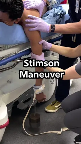 📽️ Watch our Stimson Technique Procedure Video!  Ever dealt with a stubborn dislocated shoulder? Check out our own Dr. Jess Mason, as she demonstrates the Stimson Technique combined with scapular manipulation - a great maneuver for reducing anterior shoulder dislocations. In this video, you'll learn: ✅ Proper positioning of the patient ✅ How to provide constant traction to the arm ✅ Scapular manipulation techniques Watch now for FREE (link in bio) #orthopedics #shoulderdislocation #stimsontechnique #reduction