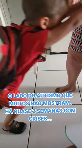 Diagnosticado desde um ano e meio, hoje com 4 anos e 8 meses, nunca tinha tido crises tão fortes como as que ele vem tendo. Há semanas vem apresentando agressividade, raiva, uma irritabilidade extrema, se contrariado, ele avança mesmo pra bater, hoje mesmo, quase que quebra o portão num ataque de fúria, e ainda tem quem diga que autismo de suporte 1 é fácil. #maeatipica #autismo #maedeautista #autismonivel1 #autistanotiktok #autista #autismoinfantil #autismobrasil #naoverbal #fluoxetina #respiridona #maedeautistacheck #tiktokautism #minharealidade #averdade #crises #atipica #meumundoazul #mamaedeautista #💙 #💙💙💙 #💙💙 