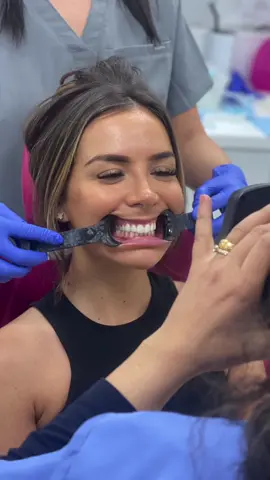 Brace face 😋 @TOOTH CLUB #toothclub #toothclubloughton #braces #fixedbraces #fixedbrace #dentist #orthodontist #loughton #essex #clearbraces 