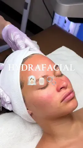 $25 off your first hydrafacial if you mention “Ananda” in the booking notes - link is in my bio 🫧 #hydrafacial #scottsdale #arizonaesthetician #fyp #skincare 