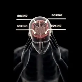 Pang myday nyo😎🥊 #boxing #box #toprank #knockout #motivation  #fyp #fypシ #viral 