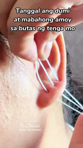 Tanggal ang dumi at mabahong amoy #earholecleaner #fyp #budolfinds #tiktokfinds #affordable #viral 