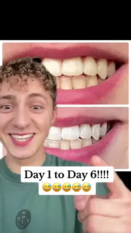 The results from DAY 1 - DAY 6 just say it all 😍👏 Have you started your teeth whitening journey yet? 👀  #teethwhiteningbeforeandafter #teethwhiteningresults #teethwhiteningstrips #peroxidefreeteethwhitening #whitesbeaconsfieldstrips 