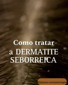 A dermatite seborreica é uma condição cutânea comum, caracterizada por inflamação e descamação da pele, geralmente afetando áreas como o couro cabeludo, rosto e região do peito. Embora as causas exatas não sejam completamente compreendidas, fatores como a produção excessiva de óleo pela pele, presença de um fungo chamado Malassezia, predisposição genética e desequilíbrios hormonais podem desempenhar um papel significativo. Sabemos o quanto a ocorrência persistente, a descamação e as ocorrências podem afetar sua confiança e conforto. Mas lembre-se de que você não está sozinho nessa jornada. Com uma abordagem gentil e um cuidado adequado, é possível aliviar os sintomas e promover a saúde do seu couro cabeludo. Você tem ou já passou por esse problema? Me conte nos comentários. Com minha vasta experiência em óleos essenciais e aromaterapia, posso contribuir significativamente para complementar essas abordagens, proporcionando um alívio adicional e promovendo a saúde do couro cabeludo e da pele. Se precisar de um protocolo personalizado, entre em contato comigo. #aromaterapiacapilar #oleosessenciaisparacabelo #cabelossaludaveis #tratamentonaturalparacabelo #terapiacapilar #aromaterapiaebeleza #cabelossaudaveis #aromaterapiabrasil #cabelosestilosos #cuidadoscomocabelo.