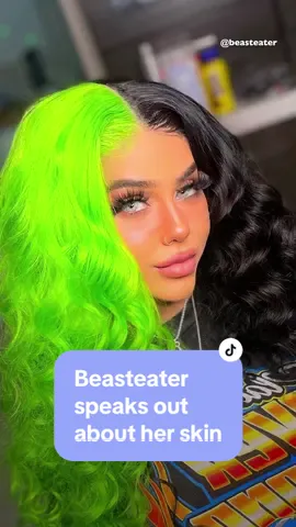 Have you been wondering what happened to Beasteater’s skin? #stephaniemargarucci #beasteater #skincare #usebydate #expirydate #skincaresafety #snapstar 