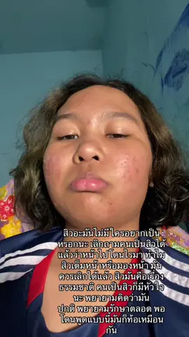 ท้อ #สิว #สิวอุดตัน #คนเป็นสิว 