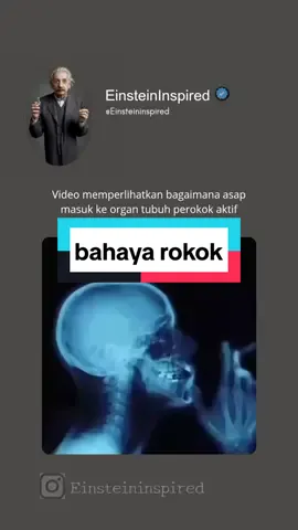 Ketika asap rokok masuk ke dalam tubuh manusia, zat-zat berbahaya yang terkandung dalam rokok akan masuk ke dalam sistem pernapasan. Asap rokok mengandung lebih dari 7.000 bahan kimia, termasuk nikotin, karbon monoksida, tar, dan banyak zat karsinogenik lainnya.   Ketika dihirup, asap rokok akan melewati saluran pernapasan dan masuk ke paru-paru. Zat-zat berbahaya dalam asap rokok ini dapat merusak jaringan paru-paru dan menyebabkan berbagai masalah kesehatan, seperti batuk kronis, infeksi pernapasan, dan penyakit paru obstruktif kronik (PPOK).   Selain itu, nikotin dalam rokok adalah zat adiktif yang dapat membuat seseorang kecanduan. Nikotin mempengaruhi sistem saraf dan menyebabkan peningkatan denyut jantung, tekanan darah, dan pernapasan. Jangka panjangnya, kecanduan rokok dapat menyebabkan penyakit jantung, stroke, kanker, dan masalah kesehatan lainnya.   Jadi, penting untuk menghindari paparan asap rokok dan menjaga kesehatan pernapasan kita. #foryoupageofficiall❤️❤️tiktok #trendingvideo #edukasi #rokok 