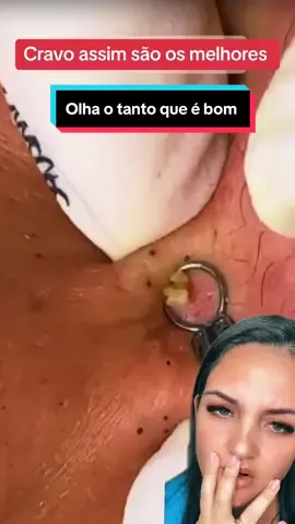 Esses aqui pra mim são os melhores #cravos #limpezasatisfatoria #reagindo 