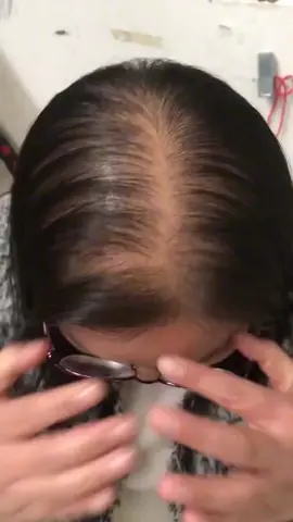 เอสเซ้นส์จากพืชบริสุทธิ์ช่วยบำรุงรูขุมขนและฟื้นฟูเส้นผมให้หนาและเต็ม ผลิตภัณฑ์แนะนำ