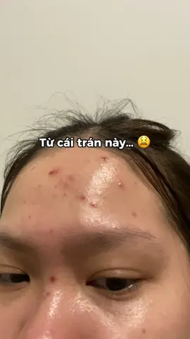 Trộm vía tìm được chân ái 🤩 #actidem #actidemvietnam #xuhuong #fyp #xh #reviewlamdep #lamdep 