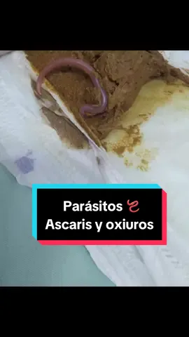 Estas imágenes corresponden a un paciente de 2 años con expulsión de parásitos en hospitalización.La ascariosis es una infección causada por un parásito llamado Ascaris lumbricoides, la transmisión es a través de agua o alimentos contaminados. Los niños pueden tener  cólicos abdominales intensos y vómitos y en casos más graves obstrucción intestinal. #gastroenterology#gastropediatraencucuta#constipation#parasitos#parasitosintestinales#dolorabdominal#saludigestiva#cucuta#nortedesantander#niños#familia#babies#
