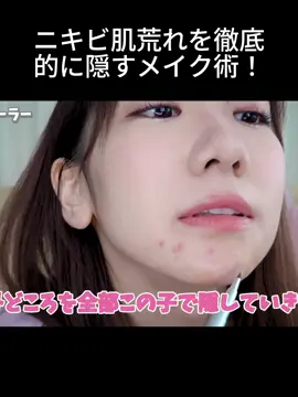 P4.ニキビ肌荒れを徹底的に隠すメイク術！