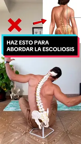 Enséñale este ejercicio a quien tenga escoliosis y esté sufriendo dolor de espalda. Con este magnífico ejercicio de control, postural, conseguirás fortalecer tu hemisferio convexo y liberar tu hemisferio cóncavo. De este modo, favorecerás la correcta, armonía y alineación de tu columna vertebral, reduciendo así los síntomas que la escoliosis deja a su paso, como por ejemplo, el dolor de espalda y el dolor de cuello. Por lo tanto, realiza este ejercicio todos los días, si tu intenciones abordar y evitar que la escoliosis vaya a más.  ##pablopilatesreal##escoliosis##postura##cifosis##scoliosis##malapostura##posturecorrection##higienepostural##controlpostural##dolordeespalda##dolorcervical##ejerciciosencasa##Fitness